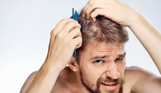 Erkeklerde Saç Dökülmesi Hangi Doktora Gitmeliyim